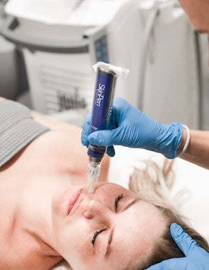 Series of 3: Collagen Induction Therapy (Microneedling) with SkinPen - Full Face
